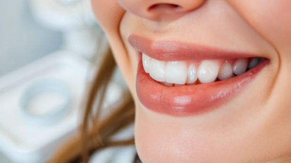 Les aligneurs français : avantages à considérer pour votre sourire